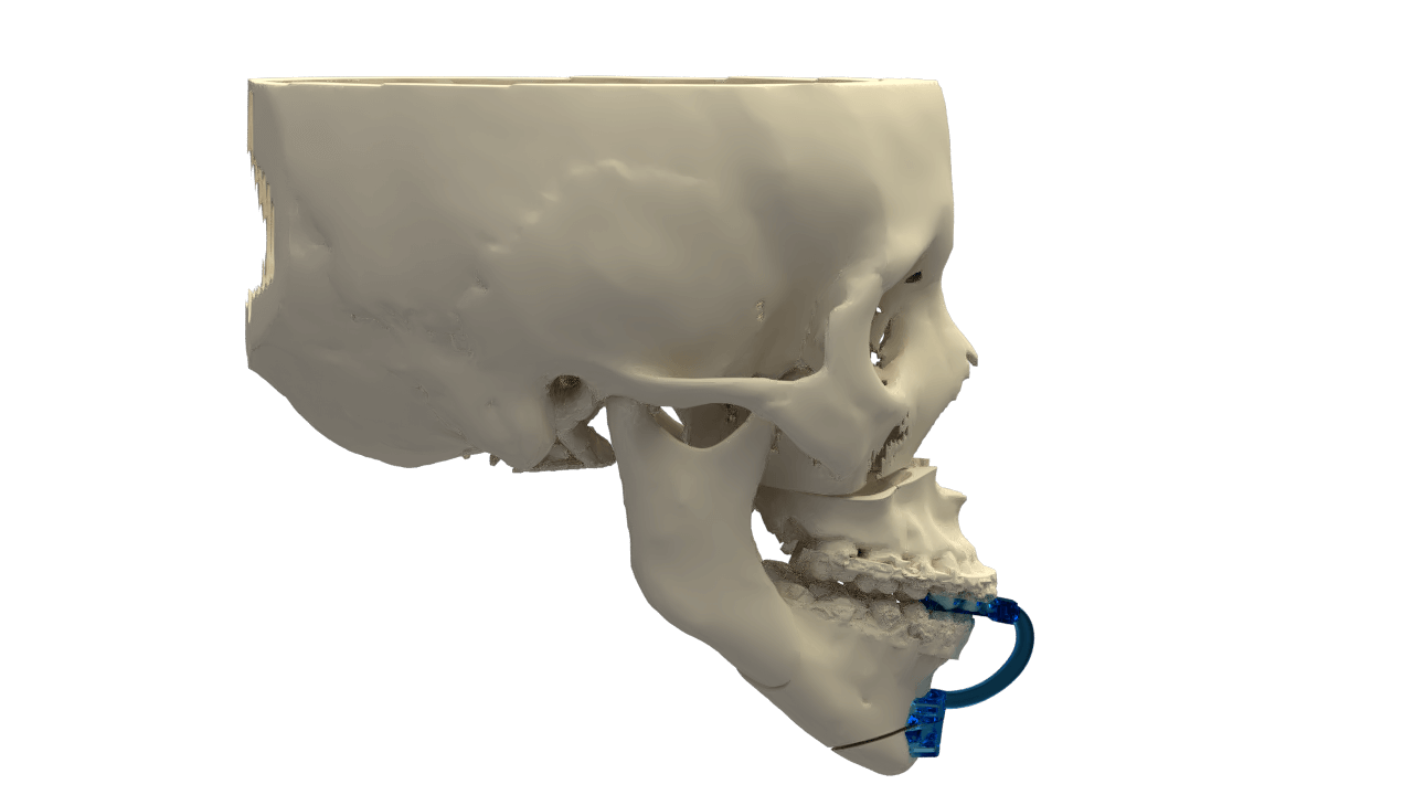 guias corte menton l