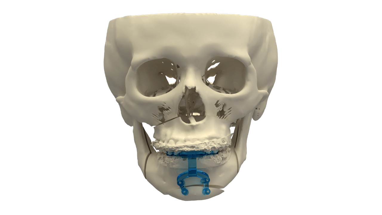 guias posicionamiento menton