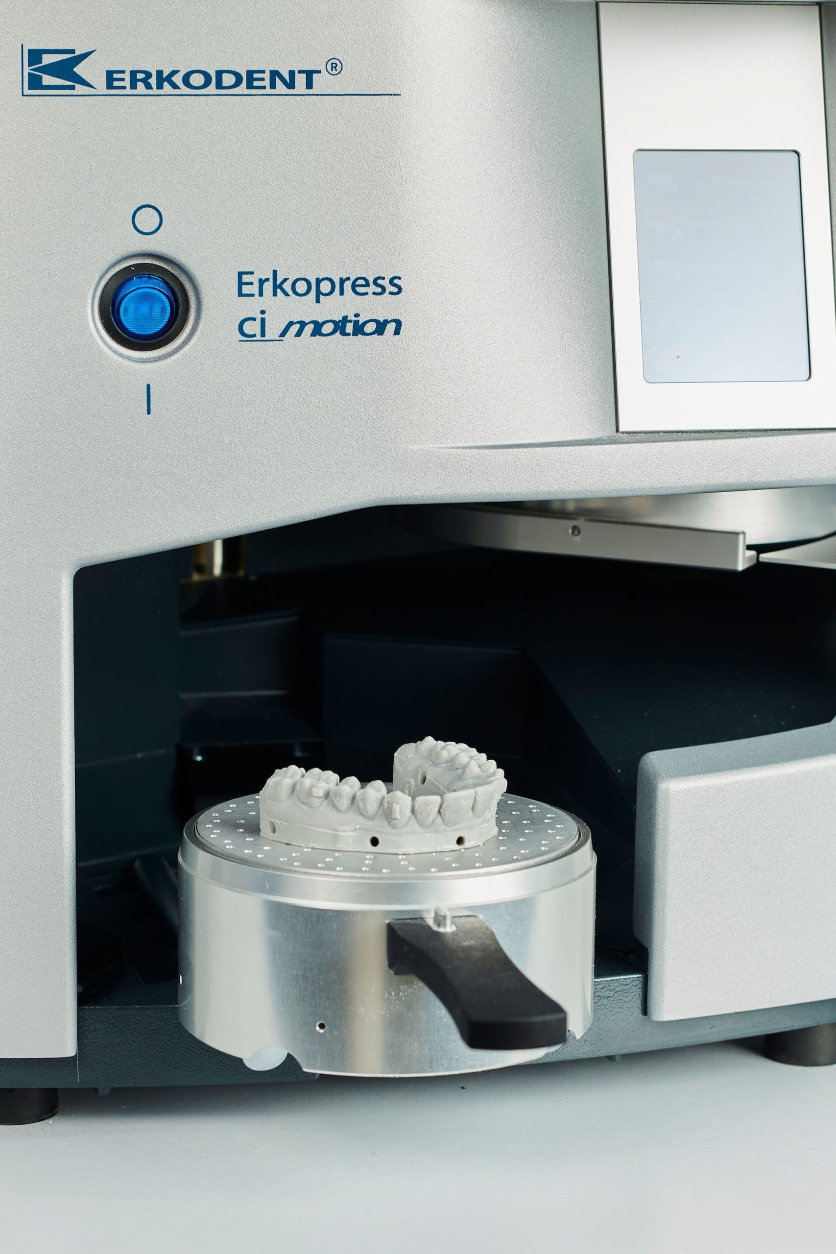 Diseño CAD/CAM para implantes a medida – MeshLab